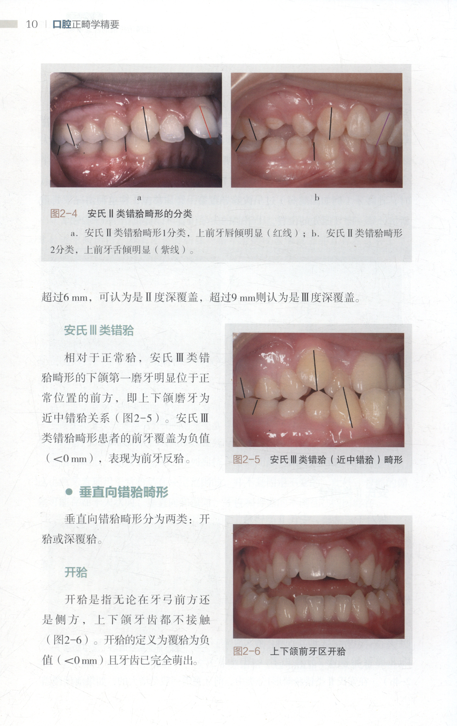 1653317203609828.jpg 详情-01.jpg