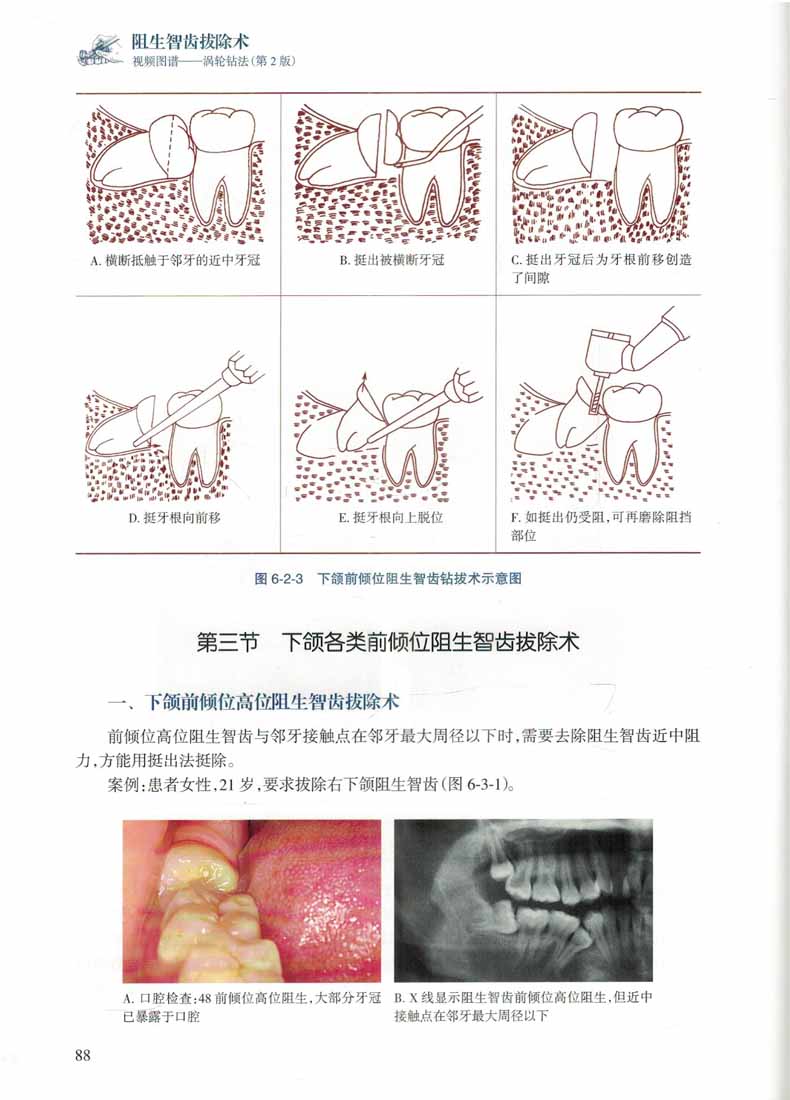 1660829788276715.jpg 详情5.jpg