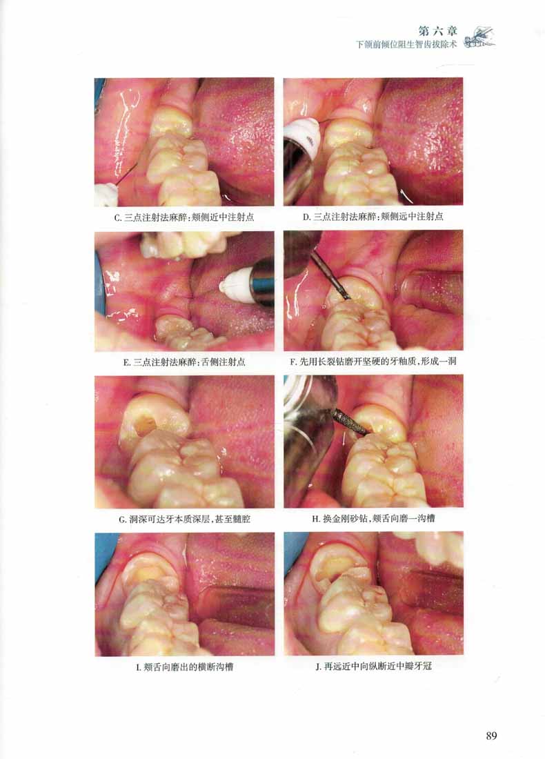 1660829793209233.jpg 详情6.jpg