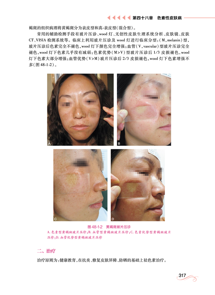 1662118461923749.jpg 详情-03.jpg