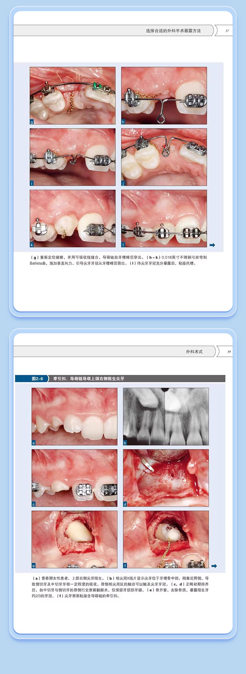 1702890293946912.jpg 详情5.jpg