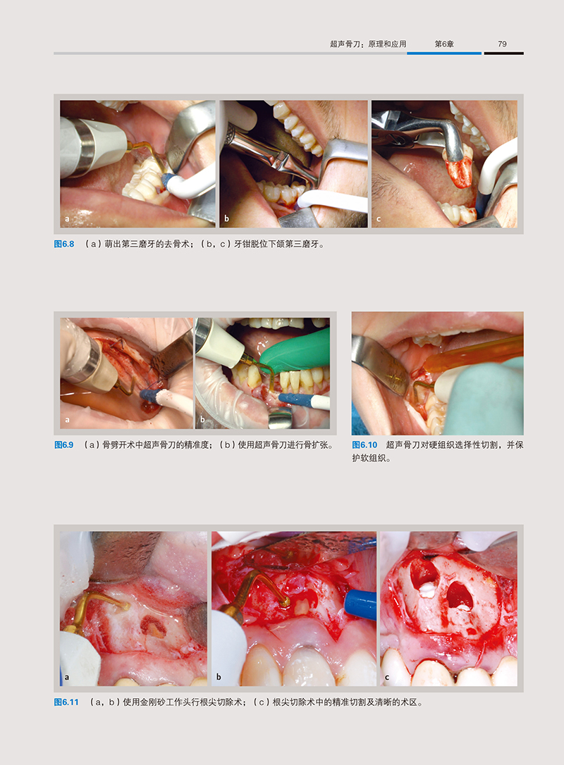 1702890595332204.jpg 详情13.jpg