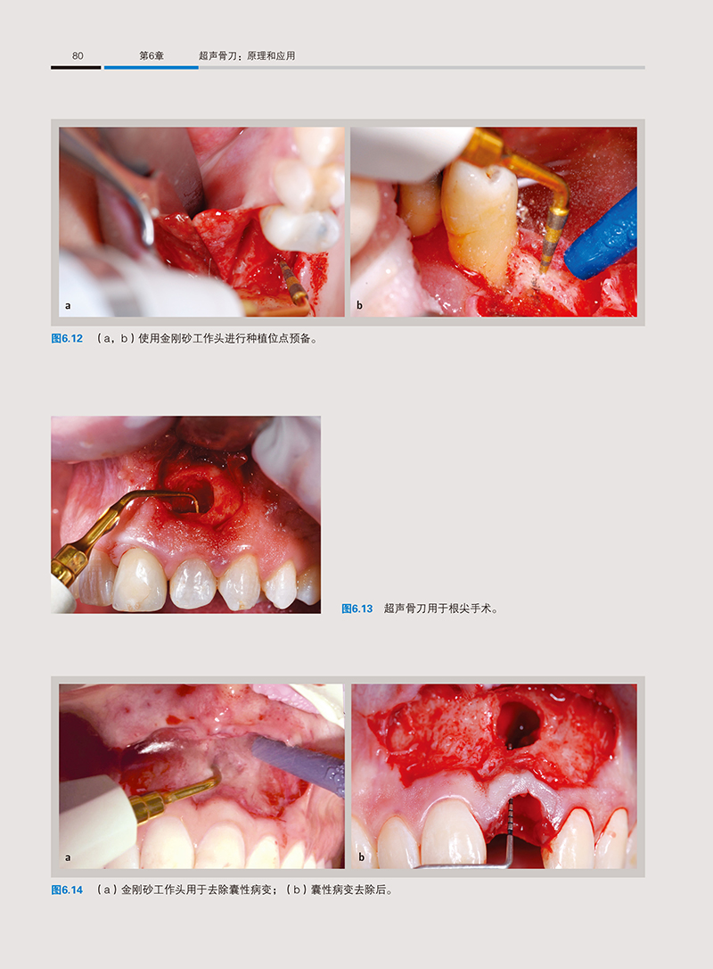1702890600451228.jpg 详情14.jpg
