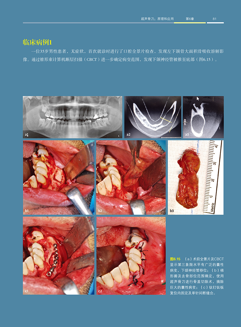 1702890604497790.jpg 详情15.jpg